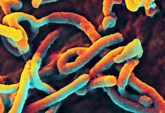 Ebola Virus Protein