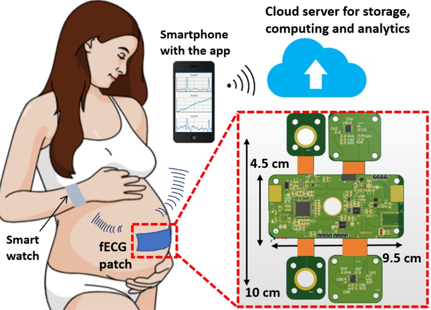 Concept drawing of the full fetal ECG monitoring system, made by researchers in professor Hung Cao’s HERO Lab. 