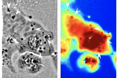 The black and white phase microscope image above helped UCI researchers identify where the squid reflectin protein nanostructures were present in human cells (dark regions, with some indicated by white arrows). The panel in color shows the associated pathlength for light traveling through a given area (red corresponds to longer pathlengths and blue corresponds to shorter pathlengths). Atouli Chatterjee / UC
